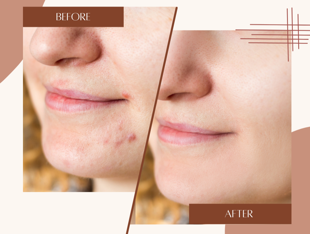 Smiling woman with naturally glowing skin using herbal skincare products