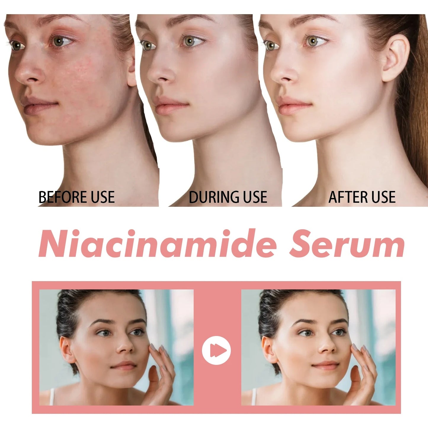 Brightening serum for blemish-prone skin