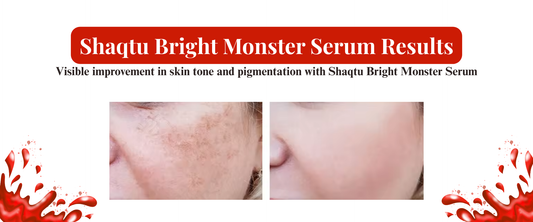 Shaqtu Bright Monster Serum before and after results showing reduction in dark spots and pigmentation