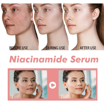 Brightening serum for blemish-prone skin